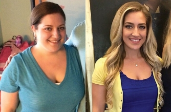 Lakukan Diet Keto, Berat Badan Wanita Ini Turun 27 Kg
