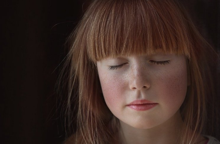 ilustrasi anak dengan freckles (pixabay)