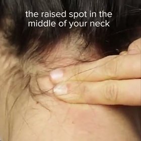 Tekan bagian tengah belakang leher. (feedytv)