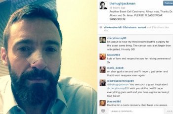 Jarang Pakai Sunscreen, Hugh Jackman Derita Kanker Kulit
