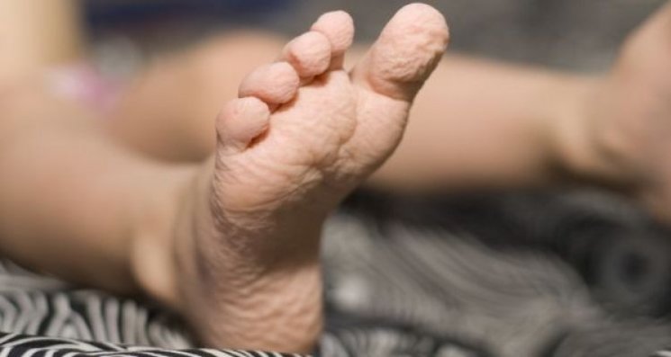 Jari kaki mengerut. (shutterstock)