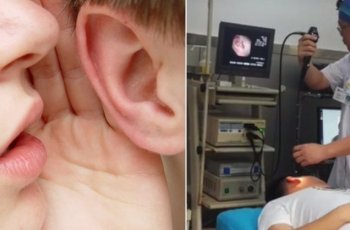Ngeri! Gendang Telinga Pria Ini Pecah Akibat Dicium Pacar