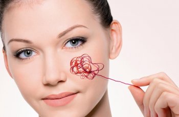 Yuk, Cari Tahu Penyebab Munculnya Spider Veins di Wajah!