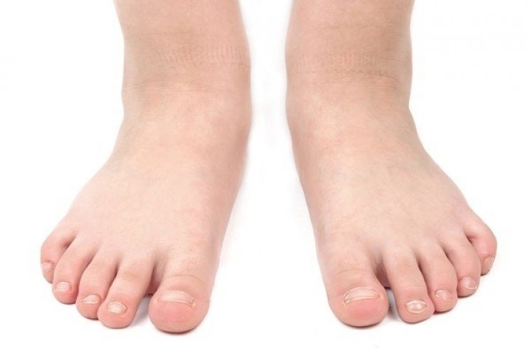 Cek kesehatan kaki. (Dream Dictionary)
