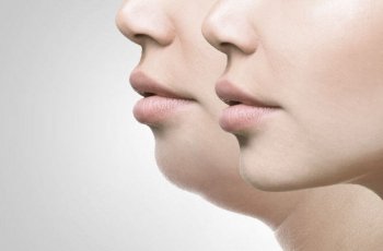 Double Chin Akan Hilang dengan Melakukan Senam Wajah Ini
