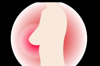 Seperti Apa Kanker Payudara pada Mammogram?
