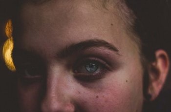 Waduh! Gadis Ini Buta Mendadak Akibat Pakai Lensa Kontak