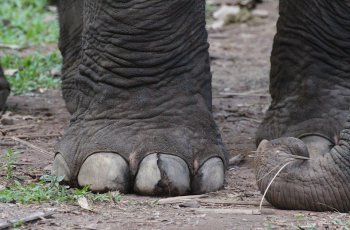 Mengenal Penyakit Kaki Gajah, Penyebab hingga Penularannya