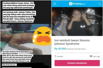 Isvi, Bocah 4 Tahun Idap Penyakit Langka Stevens Johnson Syndrome