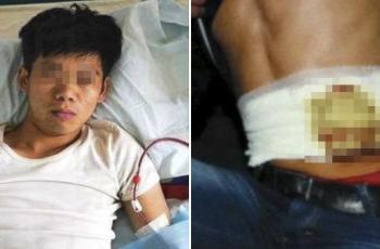 Kisah Xiao Wang Jual Ginjal untuk Beli iPhone 4 dan Nasibnya Kini