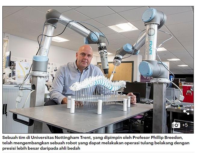 Robot yang bisa operasi tulang belakang. (Tangkapan layar dailymail)