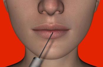 Usai Botox dan Filler Bibir, Dua Pria Kabur Tanpa Bayar Sepeser pun