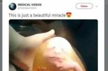 Video: Bayi Lahir dalam Keadaan Masih di Dalam Kantong Ketuban