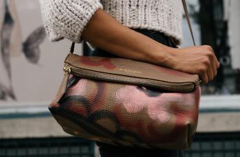 Ngeri, Wanita Ini Ingin Buat Tas dari Kulit Kakinya yang Diamputasi