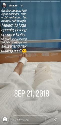 Meski kaki diamputasi, wanita ini tetap bersyukur. (Instagram/@elianurul)