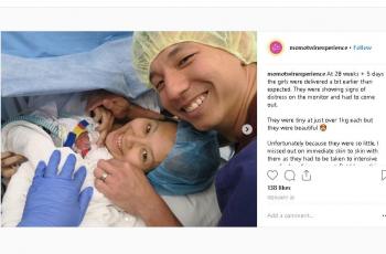 Lahir Prematur, Sepasang Bayi Kembar Ini Berpelukan Setelah 27 Hari Pisah