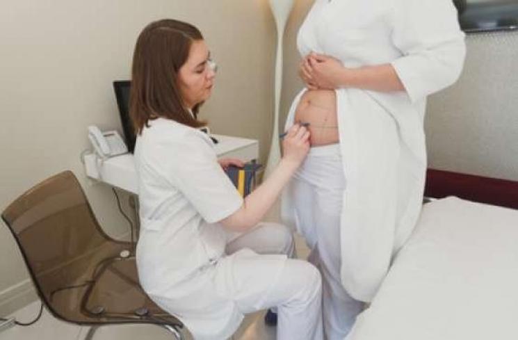 Dipikir Berat Badan Naik, Ternyata Ada Kista 23 Kg dalam Tubuh Wanita Ini