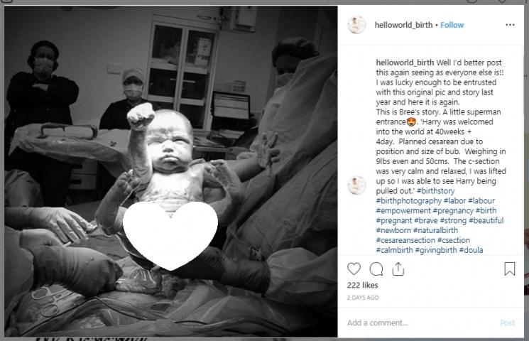 Bayi baru lahir berpose Superman. (Instagram/@helloworld_birth)
