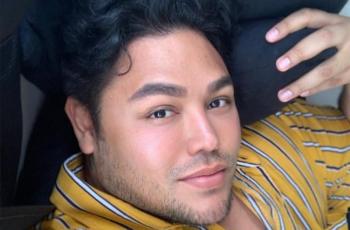 Akui Pernah Tanam Benang, Ivan Gunawan: Hidung Aku Sempat Membusuk