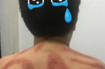 Viral Punggung Dikerok Motif Baliho Kampanye, Begini Cerita di Baliknya