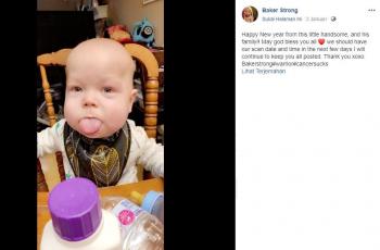Idap Kelainan Langka, Bayi 16 Bulan Ini Punya Lidah Seukuran Orang Dewasa