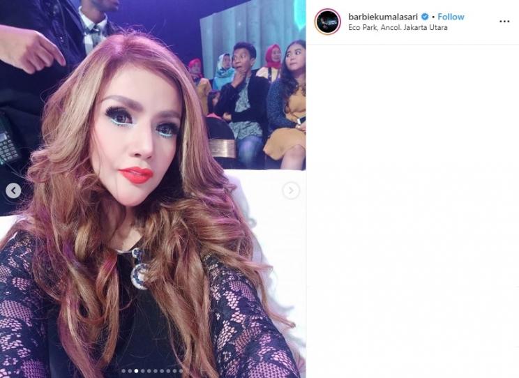 Penampilan Barbie Kumalasari dengan perawatan wajah ratusan juta (Instagram/@barbiekumalasari)