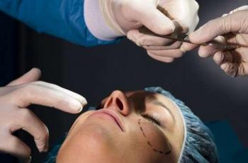 Ketahui Fakta Rhinoplasty, Operasi Hidung yang Dilakukan Puteri Novitasari