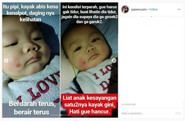 Kondisi Ryu yang semakin parah