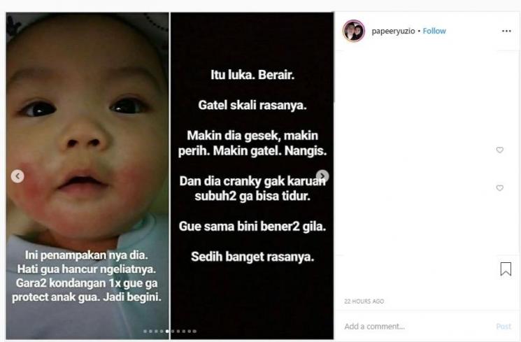 Kondisi pipi Syu setelah beberapa hari