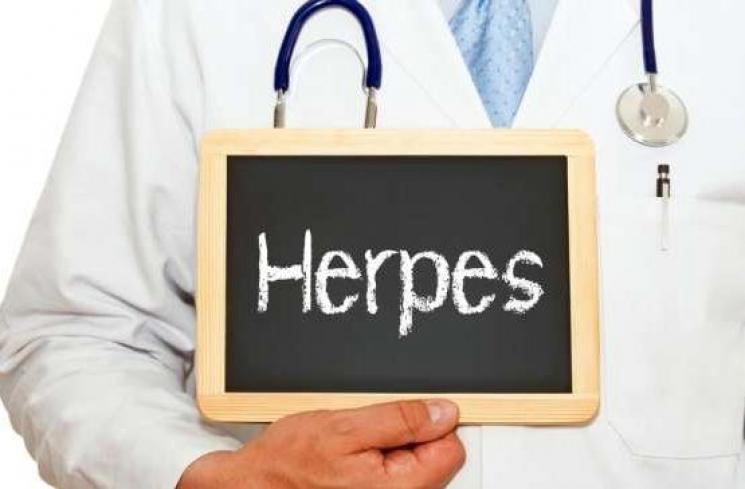 Ilustrasi penyakit herpes genital. (Shutterstock)