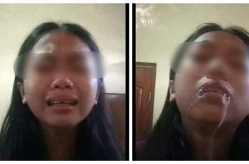 Viral Seorang Gadis Nekat Minum Sampo, Apa Bahayanya?