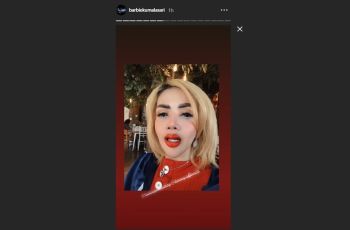 Barbie Kumalasari Sulam Bibir, Patuhi 10 Hal Ini Setelah Prosedur!