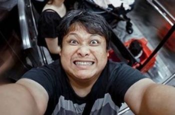 Cecep Reza Sudah Pasang Ring Jantung sebelum Meninggal, Ketahui Prosedurnya