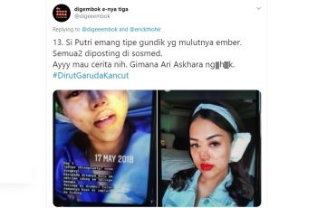 Risiko Prosedur Rhinoplasty, Mimisan hingga Hidung Kebas