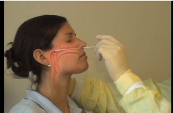 Pemerintah Diagnosis Covid-19 dengan Rapid Test, Berbeda dengan Swab?