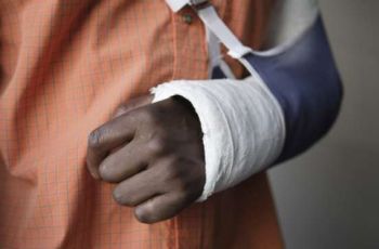 Perban 'Ajaib', Ciptaan Dokter Inggris yang Cepat Sembuhkan Patah Tulang