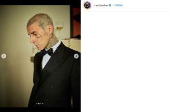 Travis Barker Sempat Jalani Kolonoskopi Sebelum Idap Pankreatitis, Adakah Hubungannya?